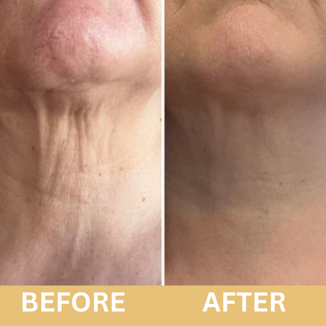 Voxerra Neck Lifting Firming Cream