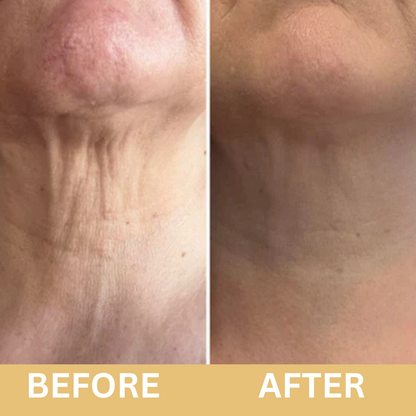 Voxerra Neck Lifting Firming Cream